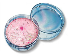 Petri dishes with mold